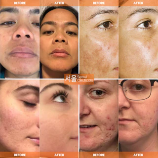 Day Glow Vitamin C Serum