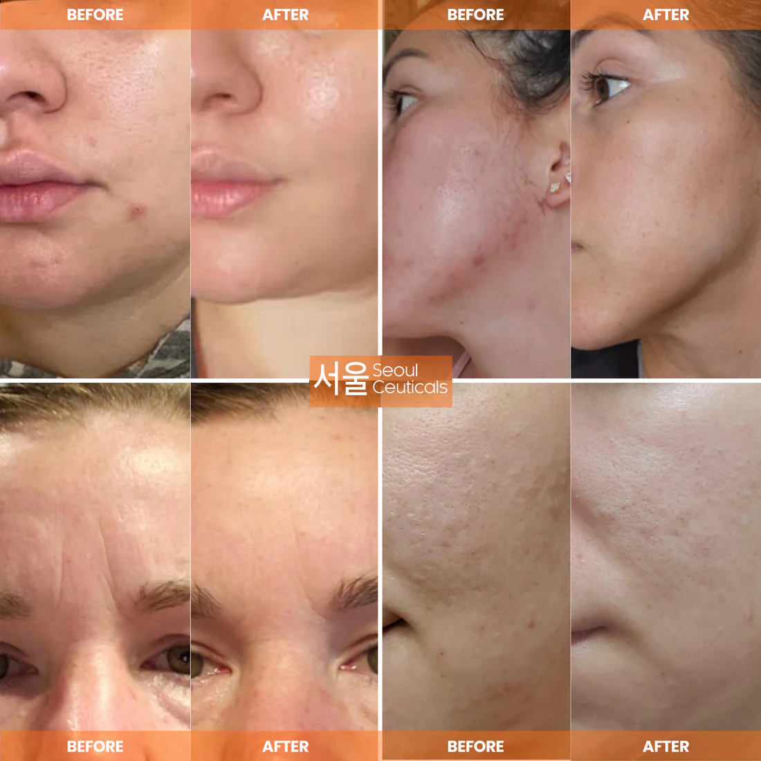 Snail Repair Cream Moisturizer
